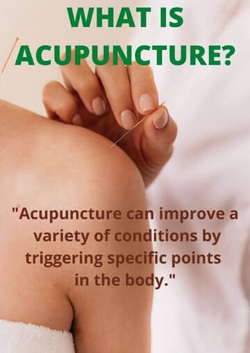 Exploring Acupuncture: Illustration of Shoulder Acupuncture Treatment and Its Meaningful Impact