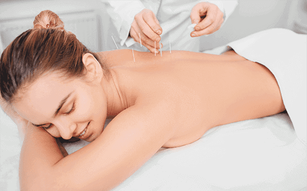 Back acupuncture treatment for pain relief