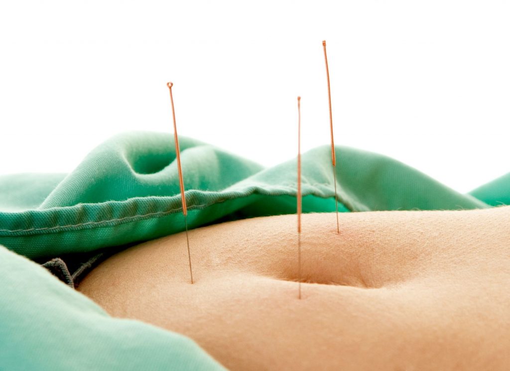 abdominal acupuncture