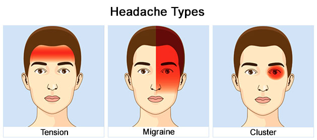 types of primary headache