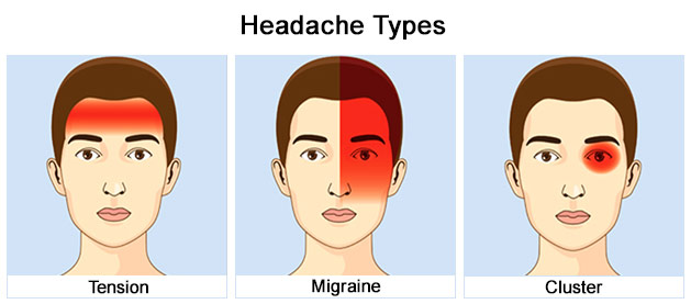 Headache is annoying! What can I do? - Happipuncture