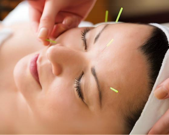 Cosmetic Acupuncture